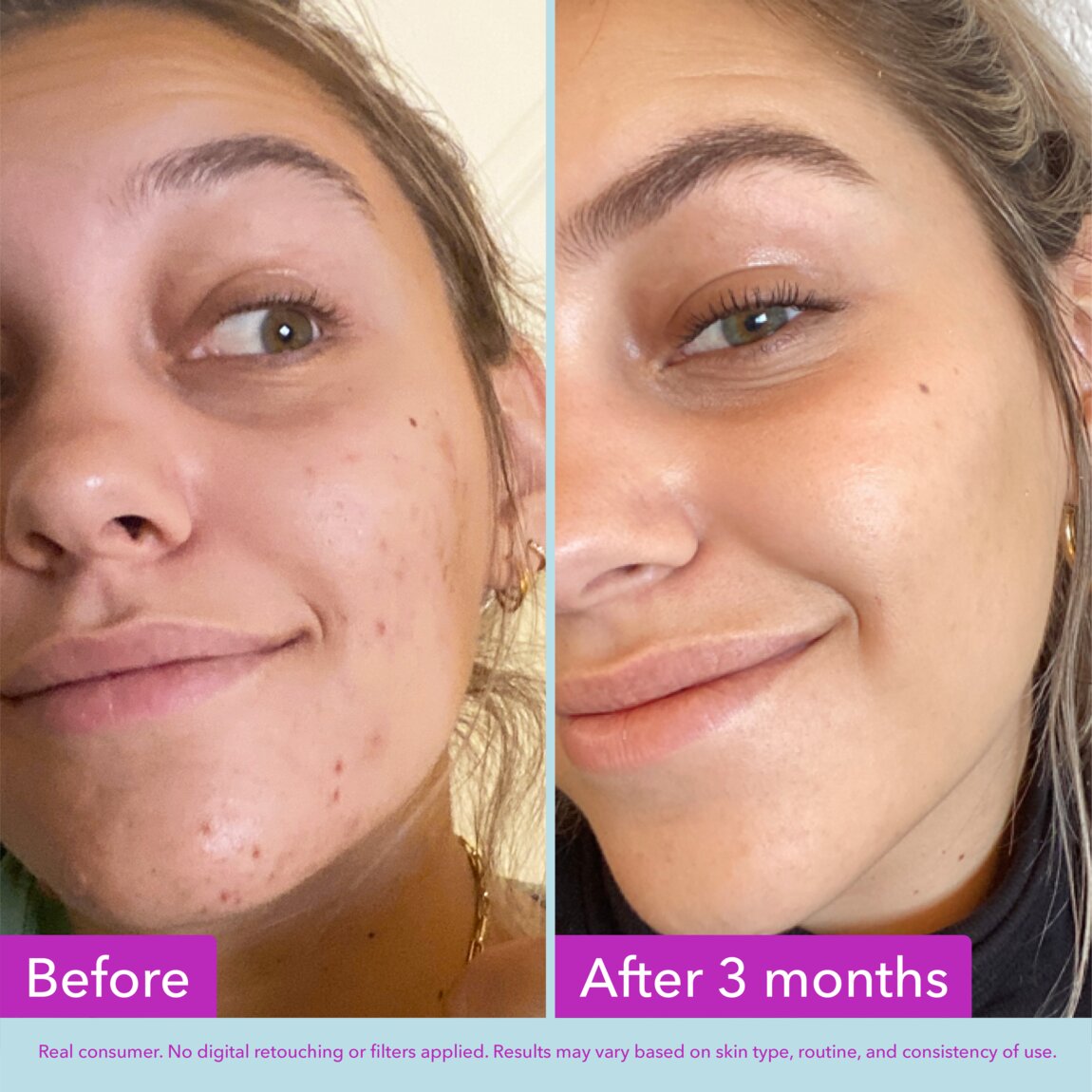 niacinamide-brightening-toner-j9 zb_p.jpg